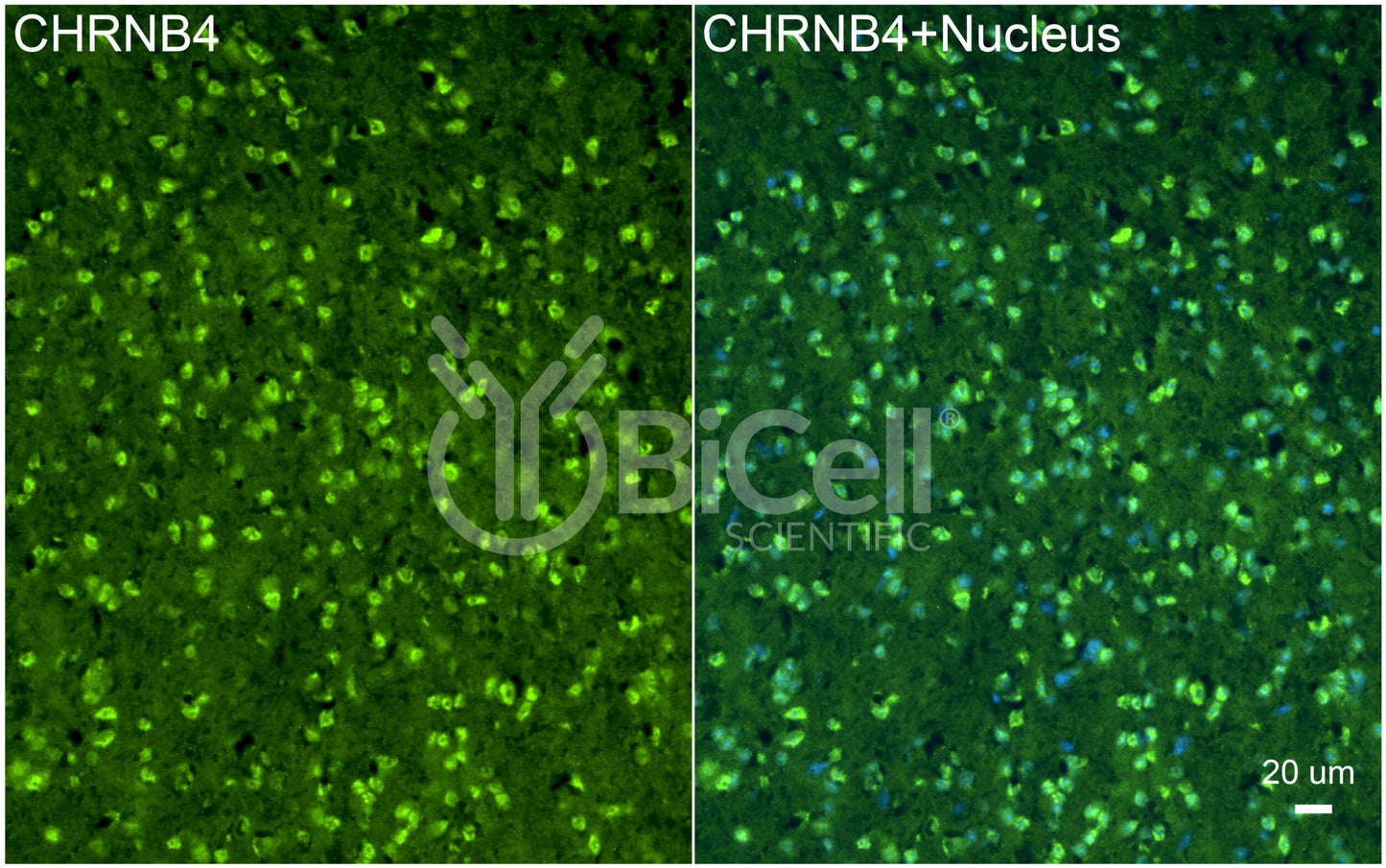 CHRNB4 Antibody