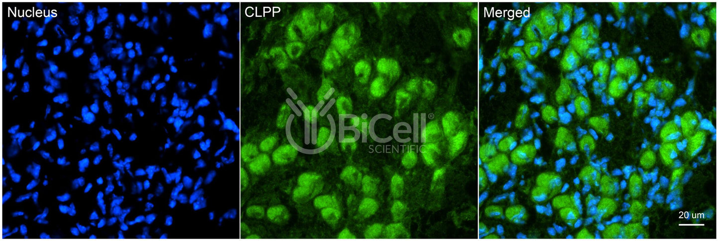 CLPP (PRLTS3 or DFNB81) Antibody - FFPE Validated