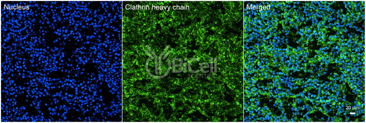 Clathrin Heavy Chain (CLTC) HiRe Antibody - FFPE Validated