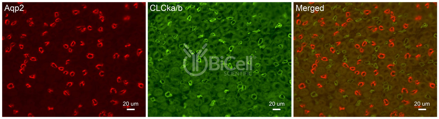 CLC-Ka/b Antibody - Western Blot Validated