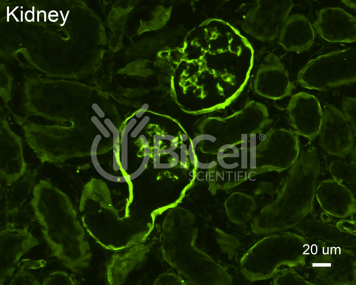 Collagen alpha-1 (IV) (Col4a1) Antibody - FFPE Validated