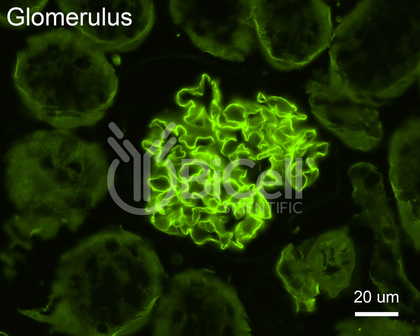 Collagen alpha-4 (IV) (Col4a4) Antibody - FFPE Validated