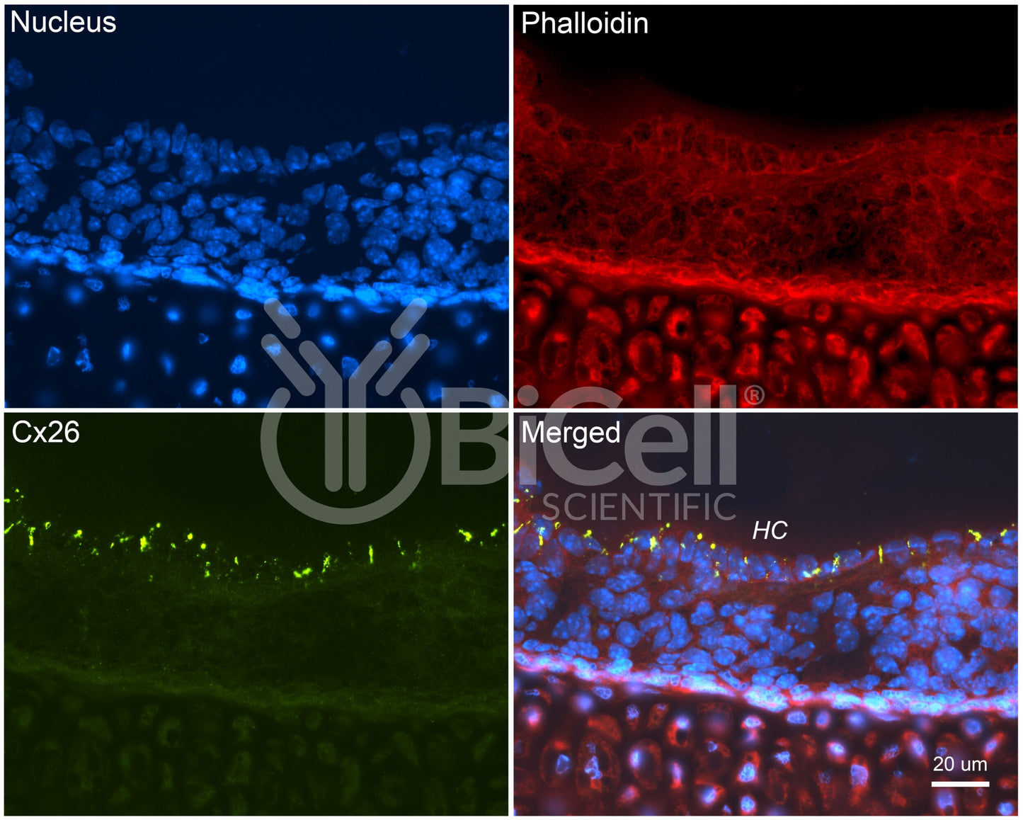 Connexin-26 (Cx26 or Gjb2) Antibody - Western Blot Validated