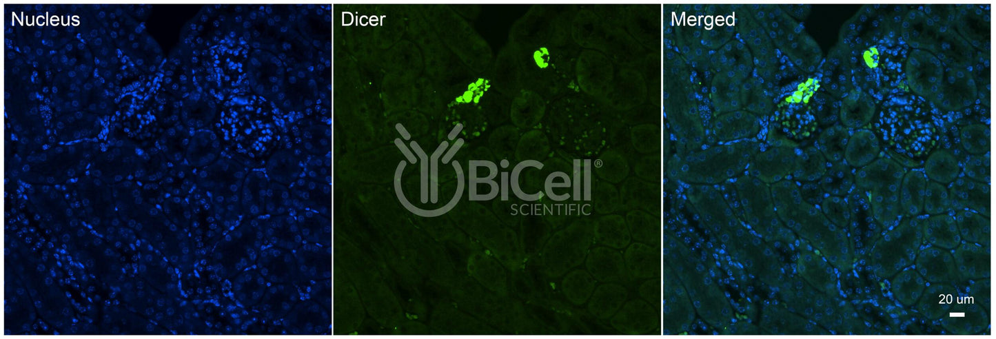 Dicer (DICER1 or DCR1) Antibody