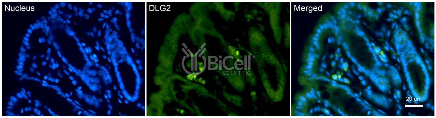 DLG2 (PSD-93 or chapsyn-110) Antibody