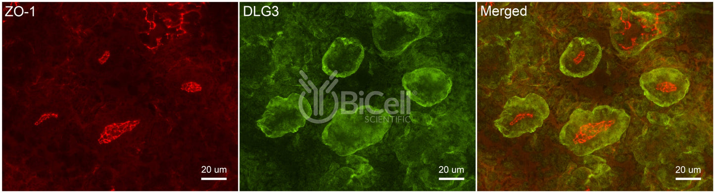 DLG3 (SAP-102 or NEDLG) Antibody - Western Blot Validated