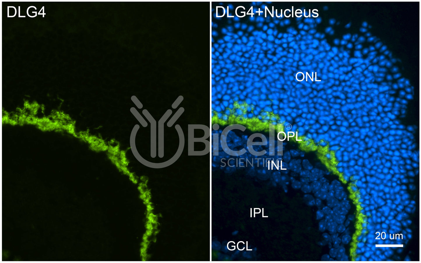 DLG4 (SAP-90 or PSD-95) Antibody - Western Blot Validated