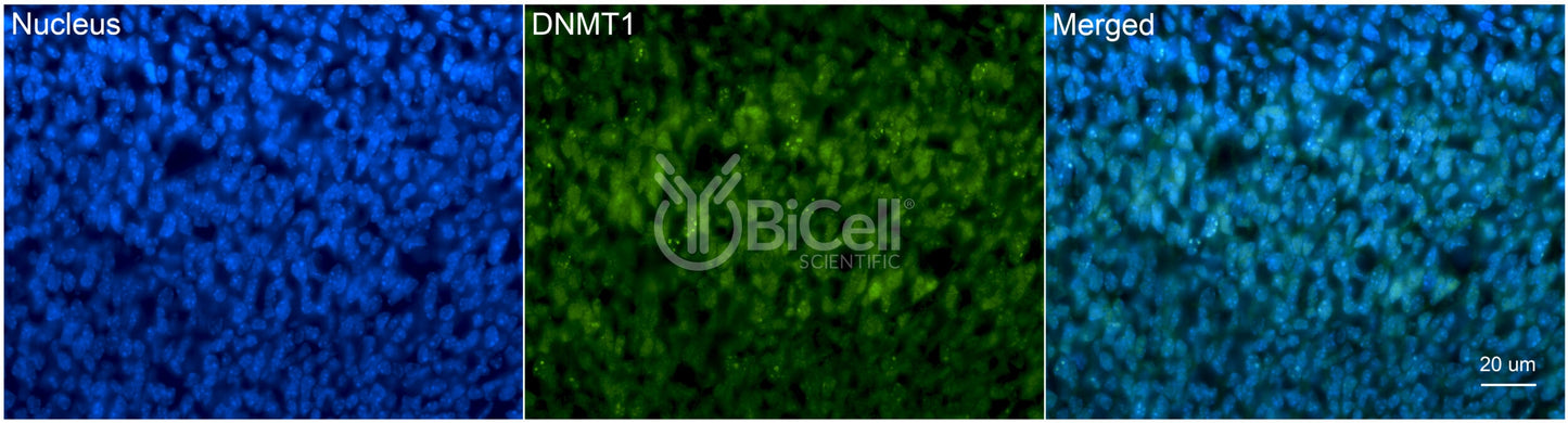 DNMT1 (DNMT) Antibody - Western Blot Validated