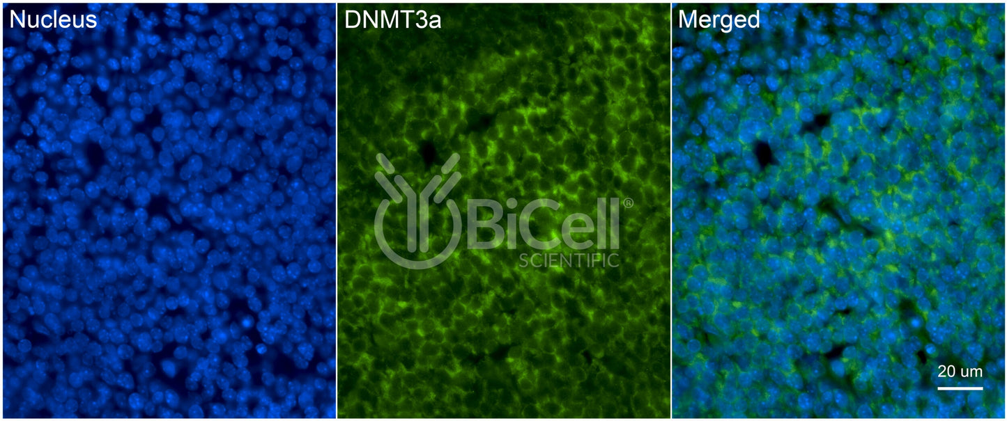 DNMT3A Antibody - Western Blot Validated