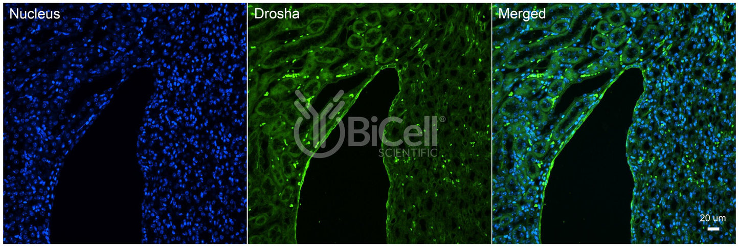 DROSHA (RNASEN) Antibody - Western Blot Validated