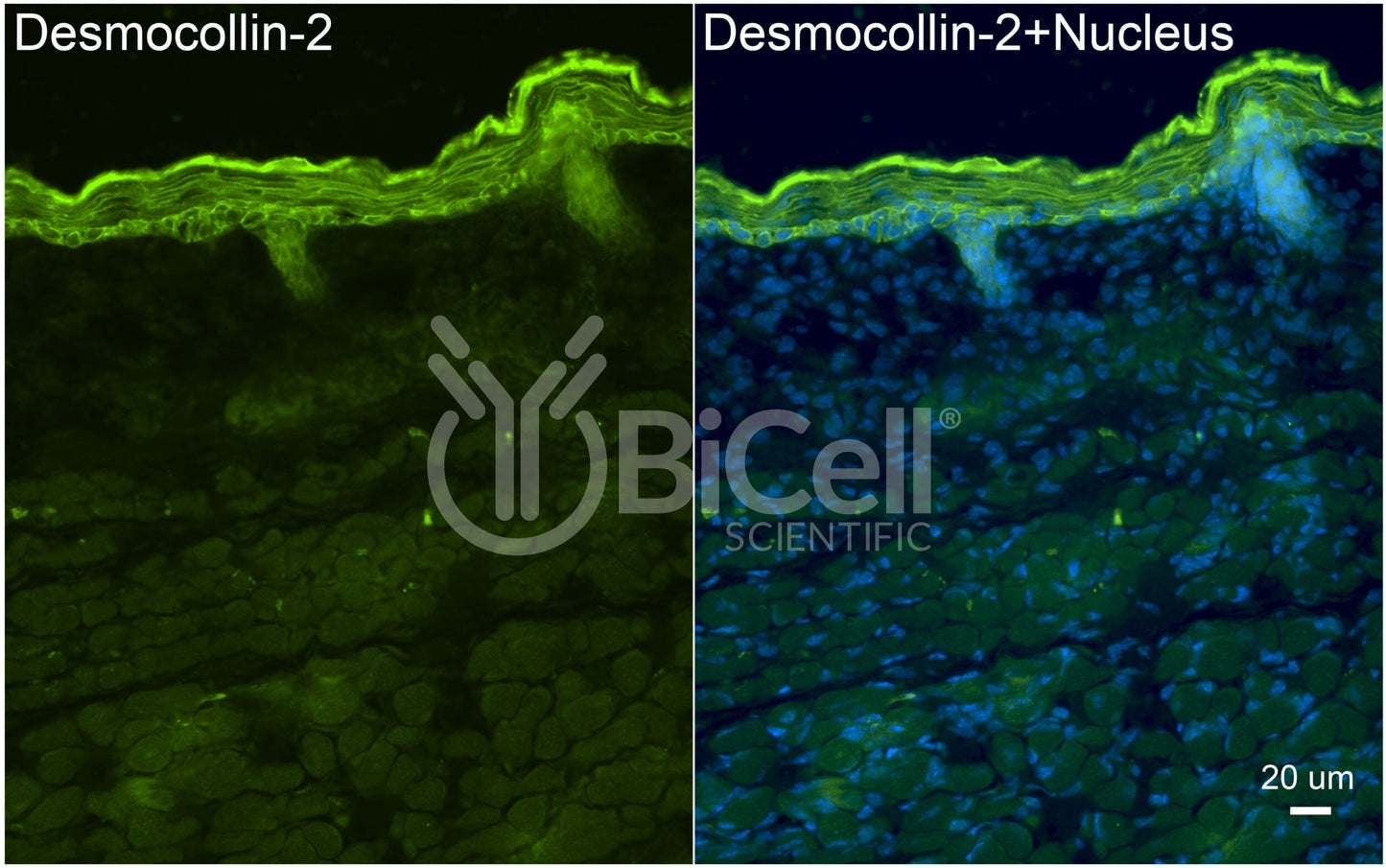 Desmocollin-2 (DSC2) Antibody - Western Blot Validated