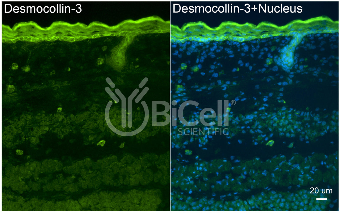 Desmocollin-3 (DSC3) Antibody