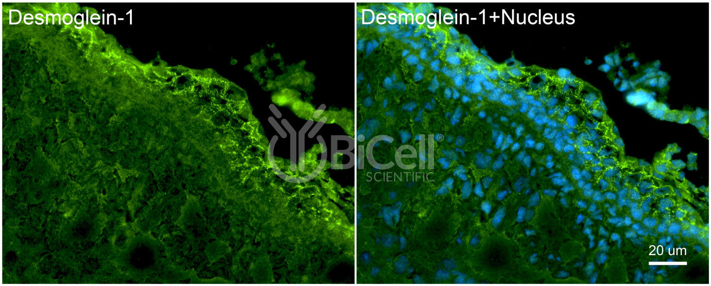 Desmoglein-1 (DSG1) Antibody - FFPE Validated