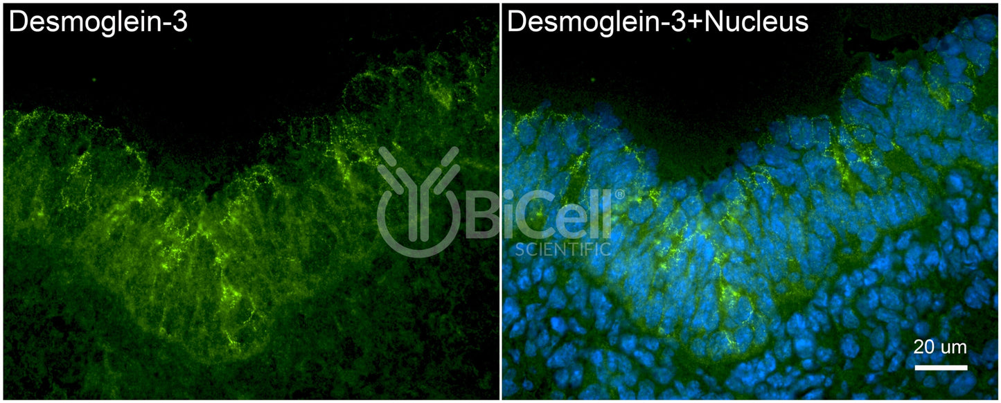 Desmoglein-3 (DSG3) Antibody - Western Blot Validated