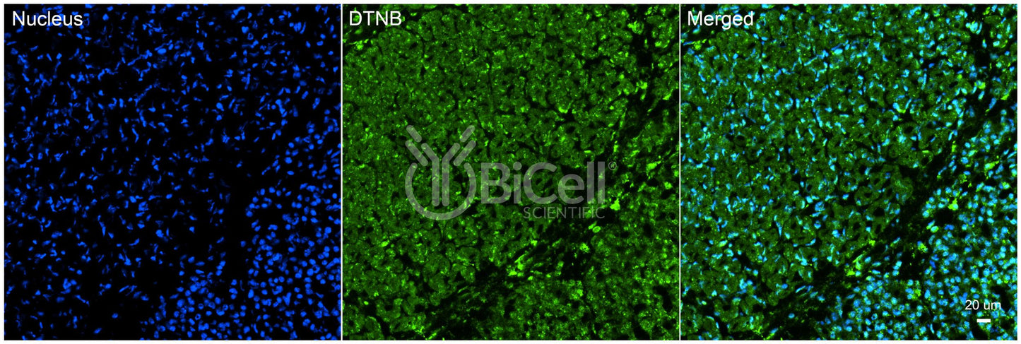 Dystrobrevin beta (DTNB) Antibody - Western Blot Validated