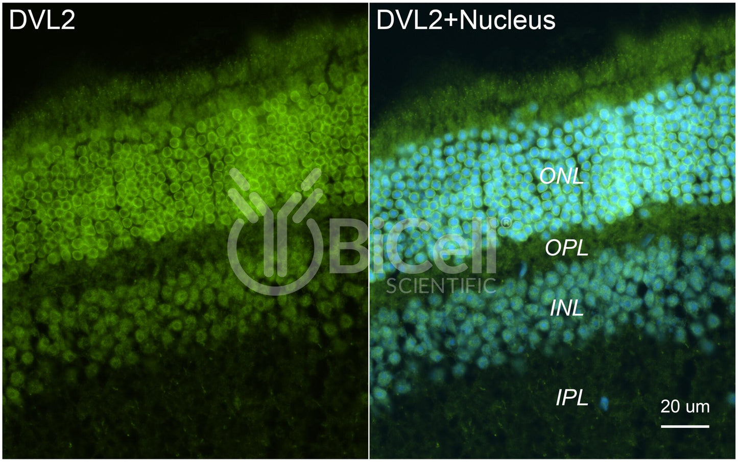 DVL2 Antibody - Western Blot Validated
