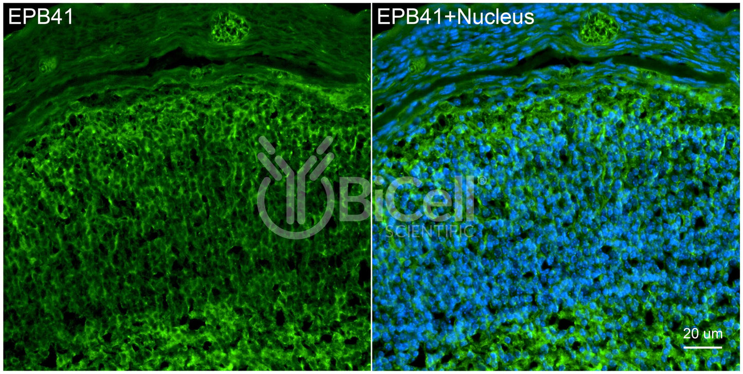 EPB41 Antibody