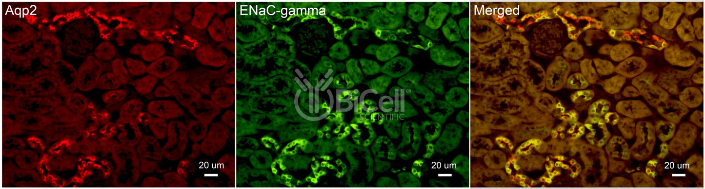 ENaC gamma (Scnn1g) Antibody - Western Blot Validated