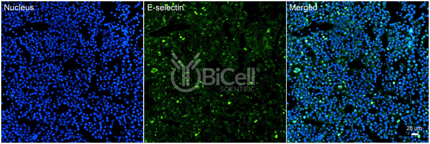 E-selectin (SELE or LECAM2 or CD62E) Antibody - Western Blot Validated