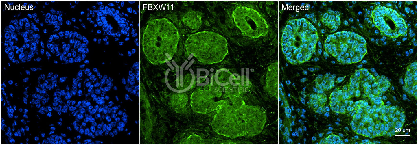 FBXW11 (BTRCP2 or NEDJED) (C-Terminus) Antibody - Western Blot Validated