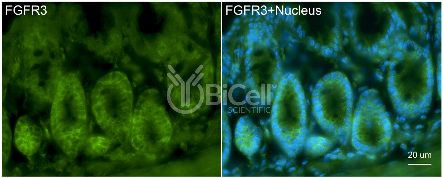 FGFR3 (CD333) Antibody - Western Blot Validated