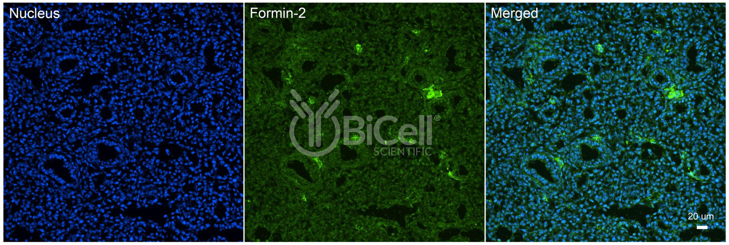 Formin-2 (FMN2) Antibody - Western Blot Validated