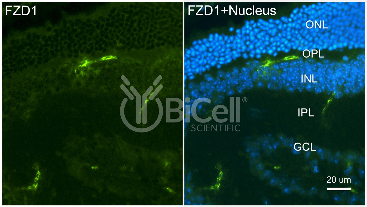 Frizzled-1 (FZD1) Antibody - Western Blot Validated
