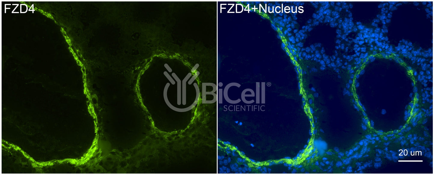 Frizzled-4 (FZD4) Antibody - FFPE Validated