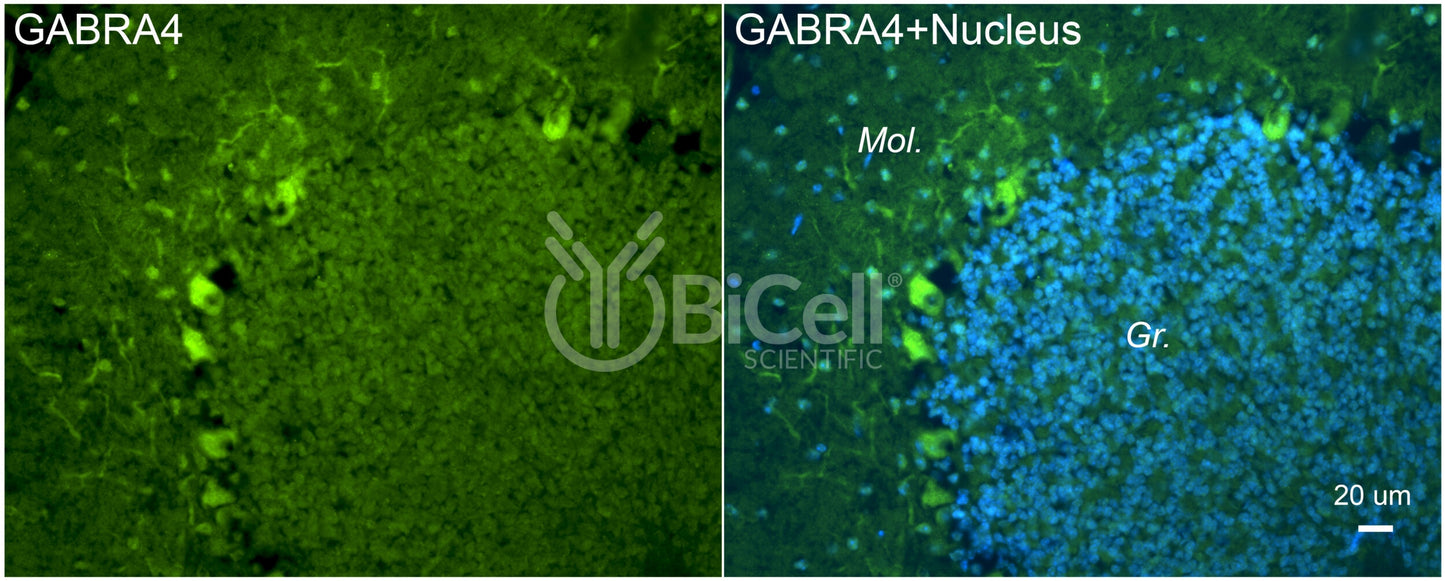 GABRA4 Antibody - FFPE Validated