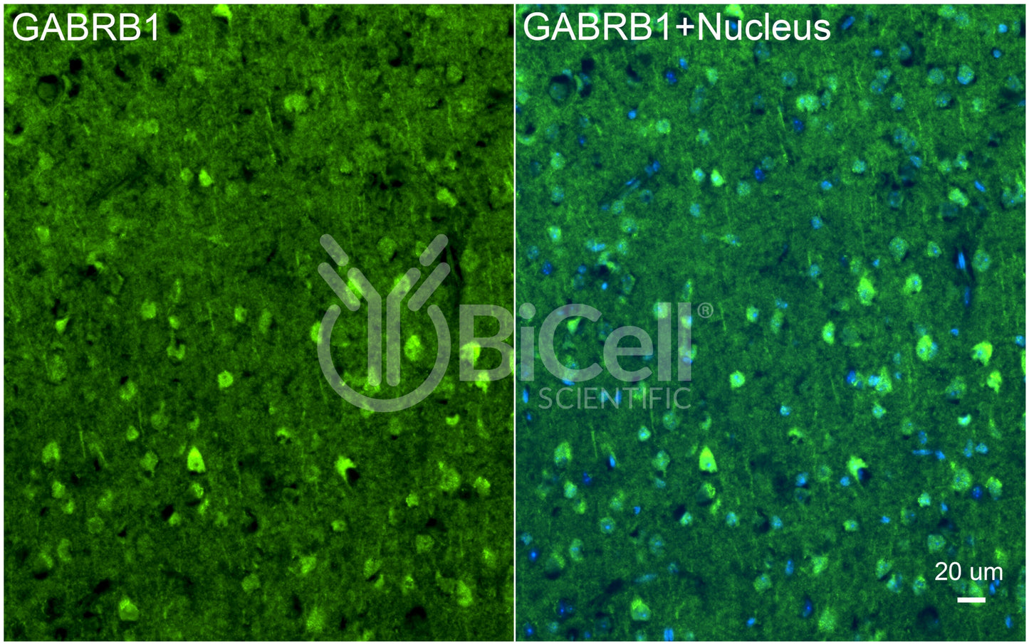 GABRB1 Antibody - Western Blot Validated
