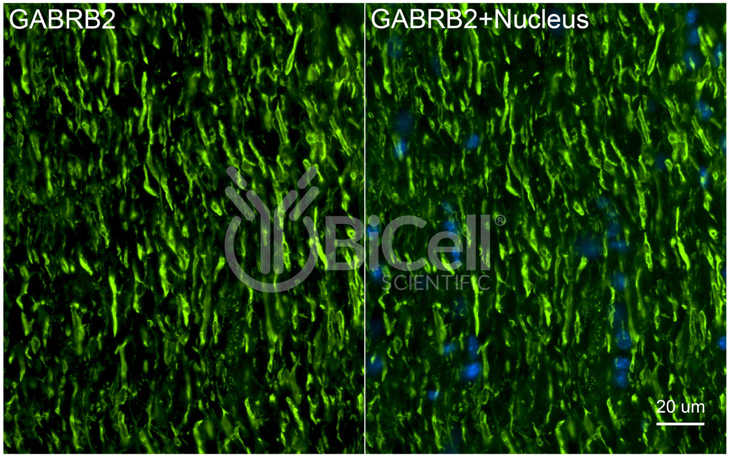 GABRB2 Antibody