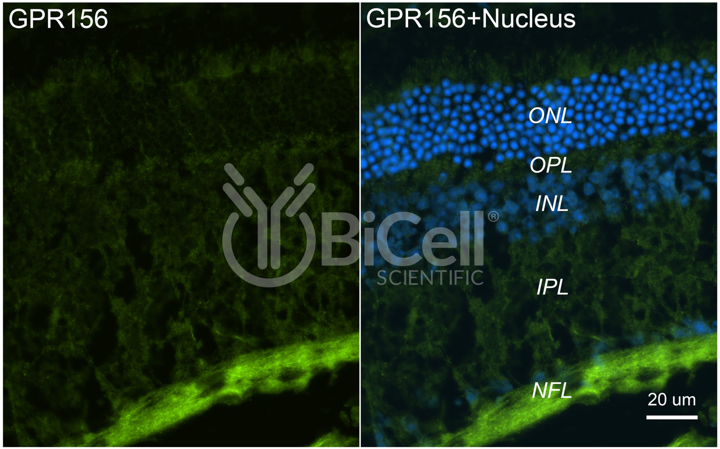 GPR156 (GABABL) Antibody