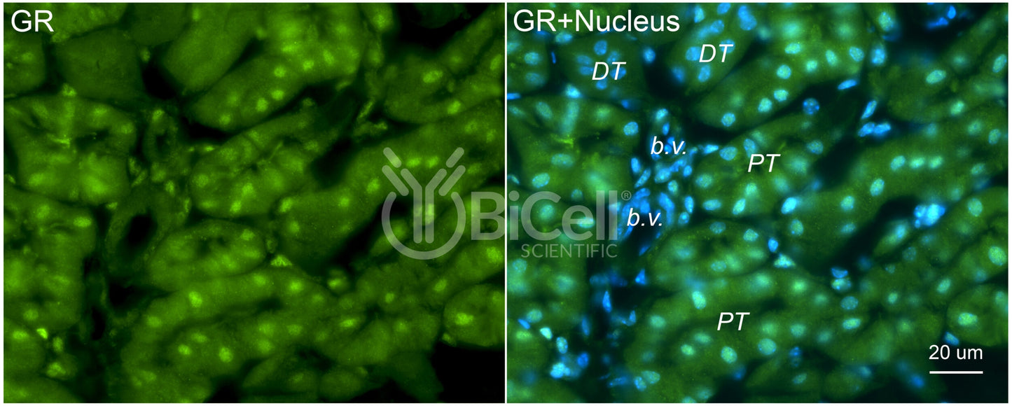 GR (NR3C1) Antibody
