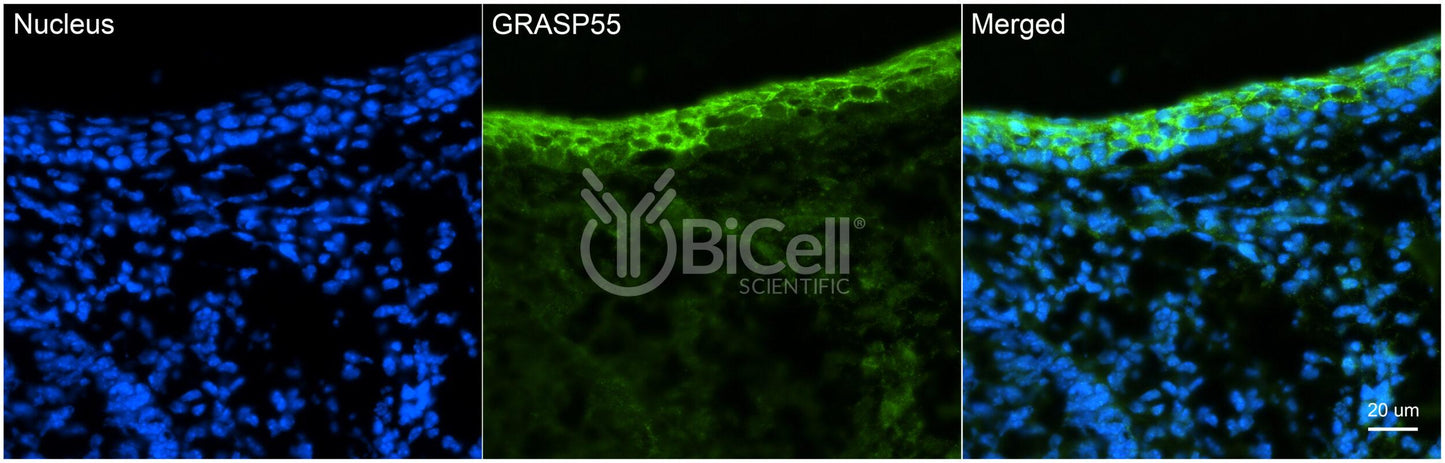 GRASP55 (GORASP2) Antibody - FFPE Validated