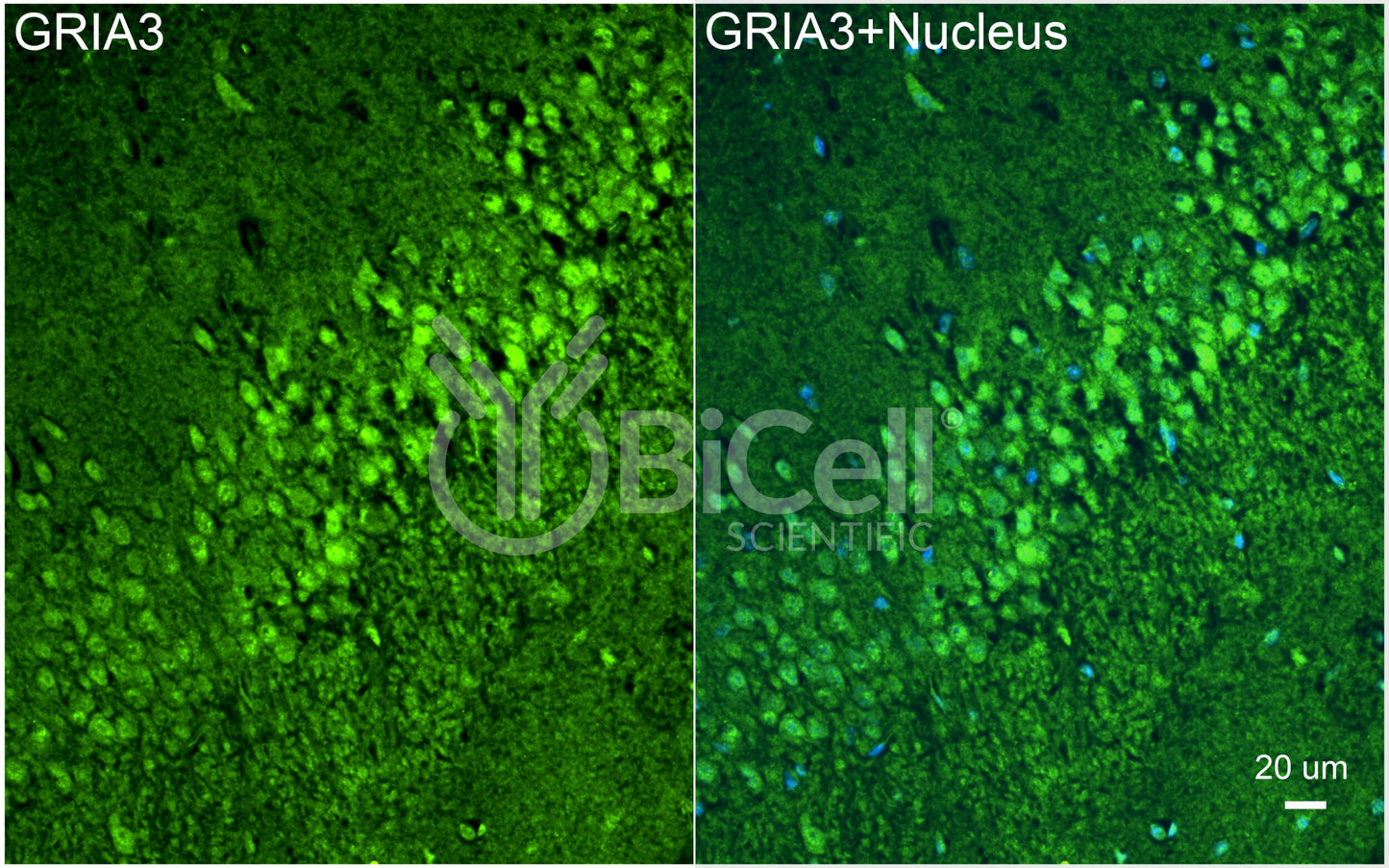 GRIA3 (GluR3 or GluA3) Antibody - FFPE Validated