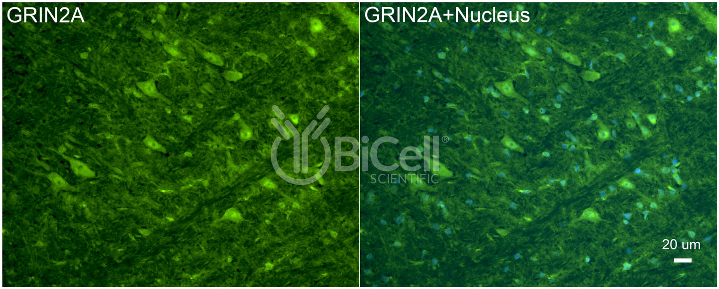 GRIN2A (GluN2A) Antibody
