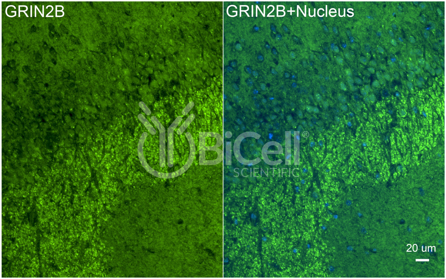 GRIN2B (GluN2B) Antibody