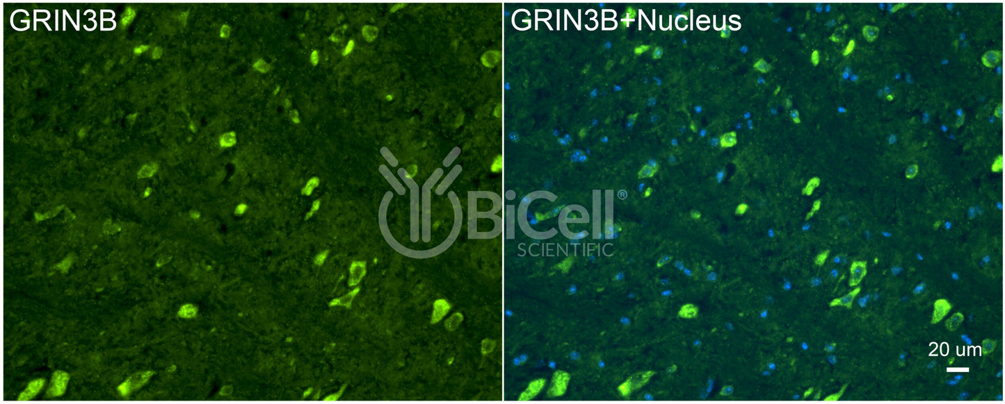 GRIN3B (GluN3B) Antibody