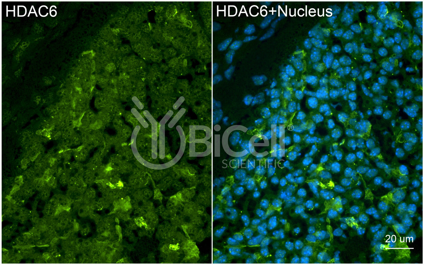HDAC6 (C-Terminus) Antibody - FFPE Validated