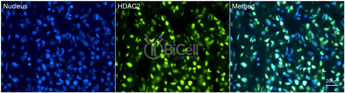 HDAC2 Antibody