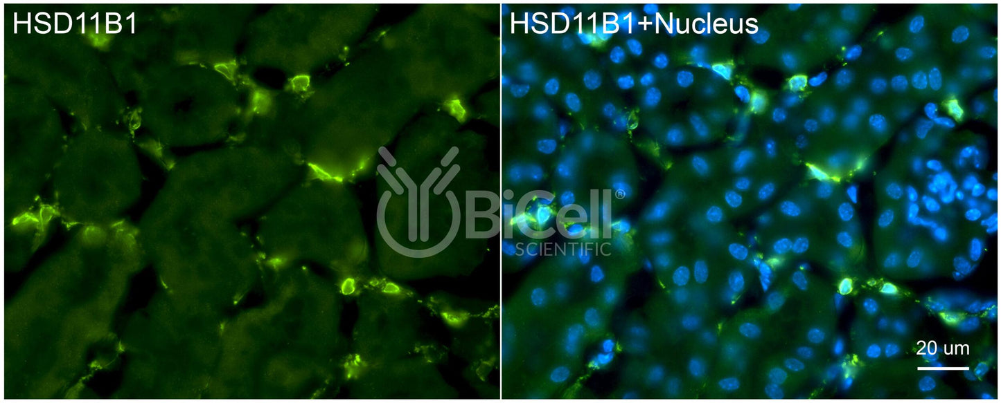 11-beta-HSD1 (HSD11B1) Antibody - FFPE Validated