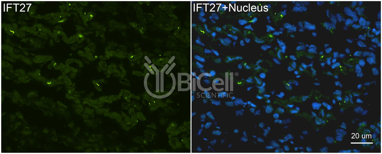 IFT27 (BBS19) Antibody