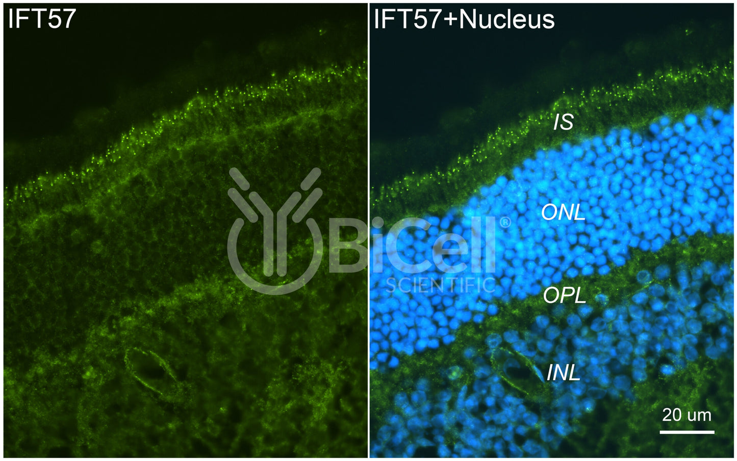 IFT57 Antibody - FFPE Validated