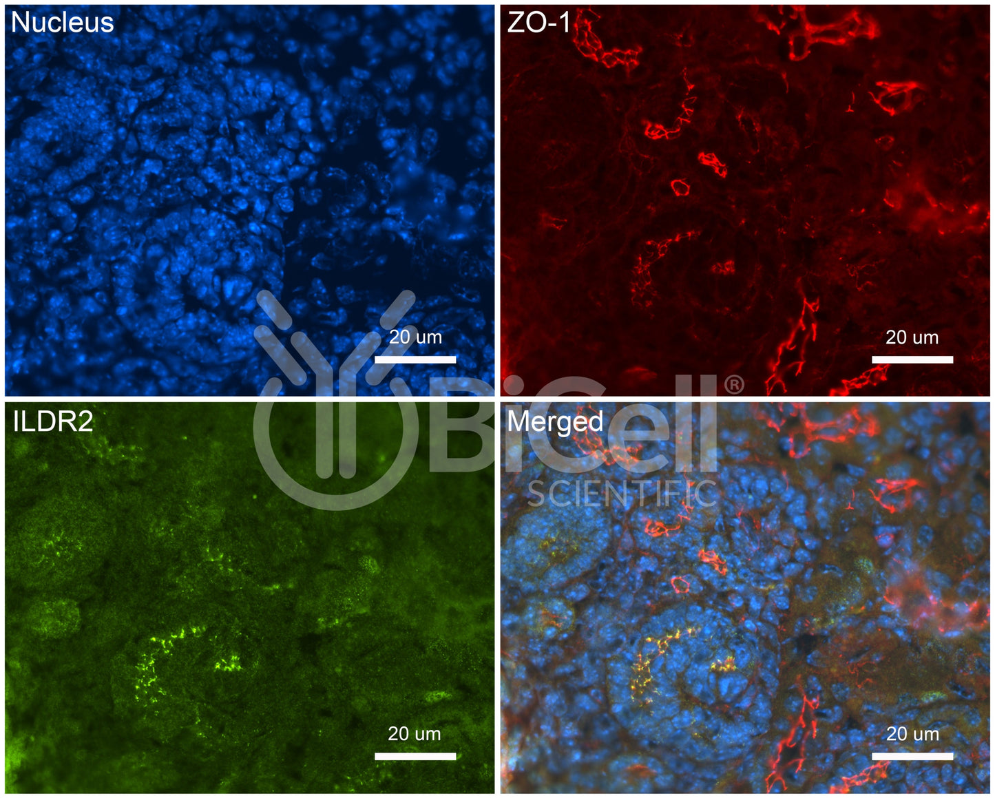ILDR2 (Angulin-3) Antibody - FFPE Validated