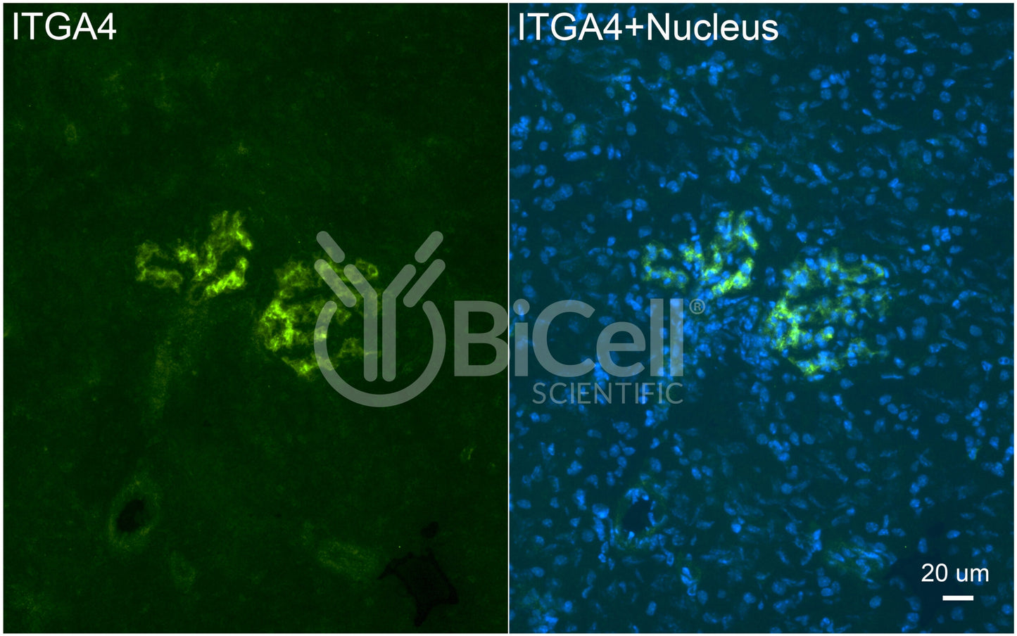 Integrin alpha-4 (ITGA4 or CD49d) Antibody - Western Blot Validated