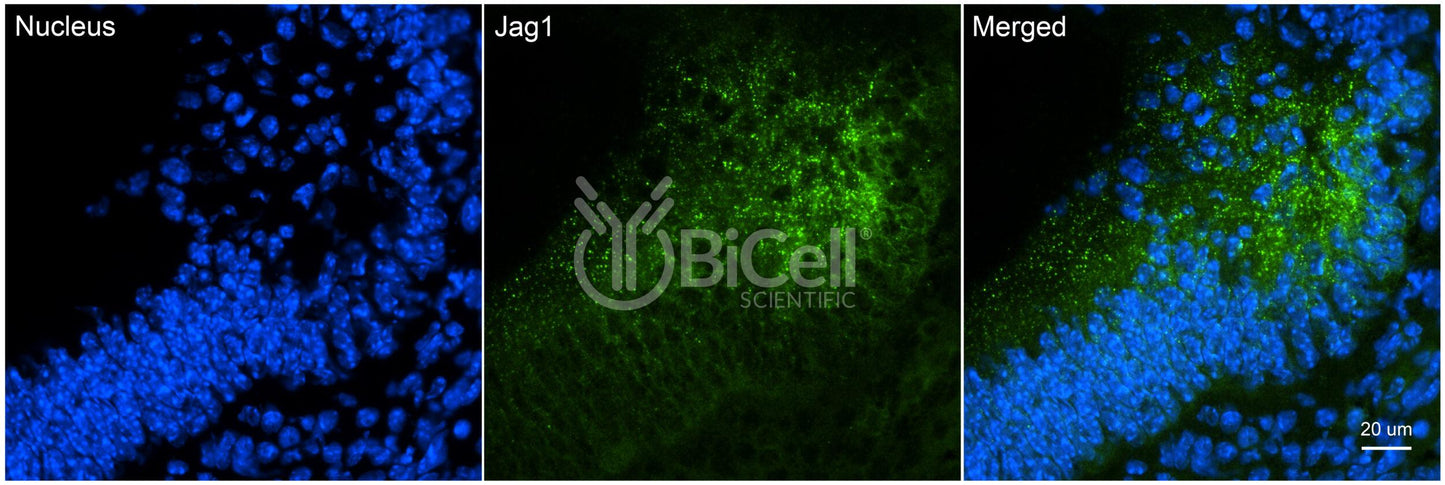JAG1 (CD339) Antibody - Western Blot Validated