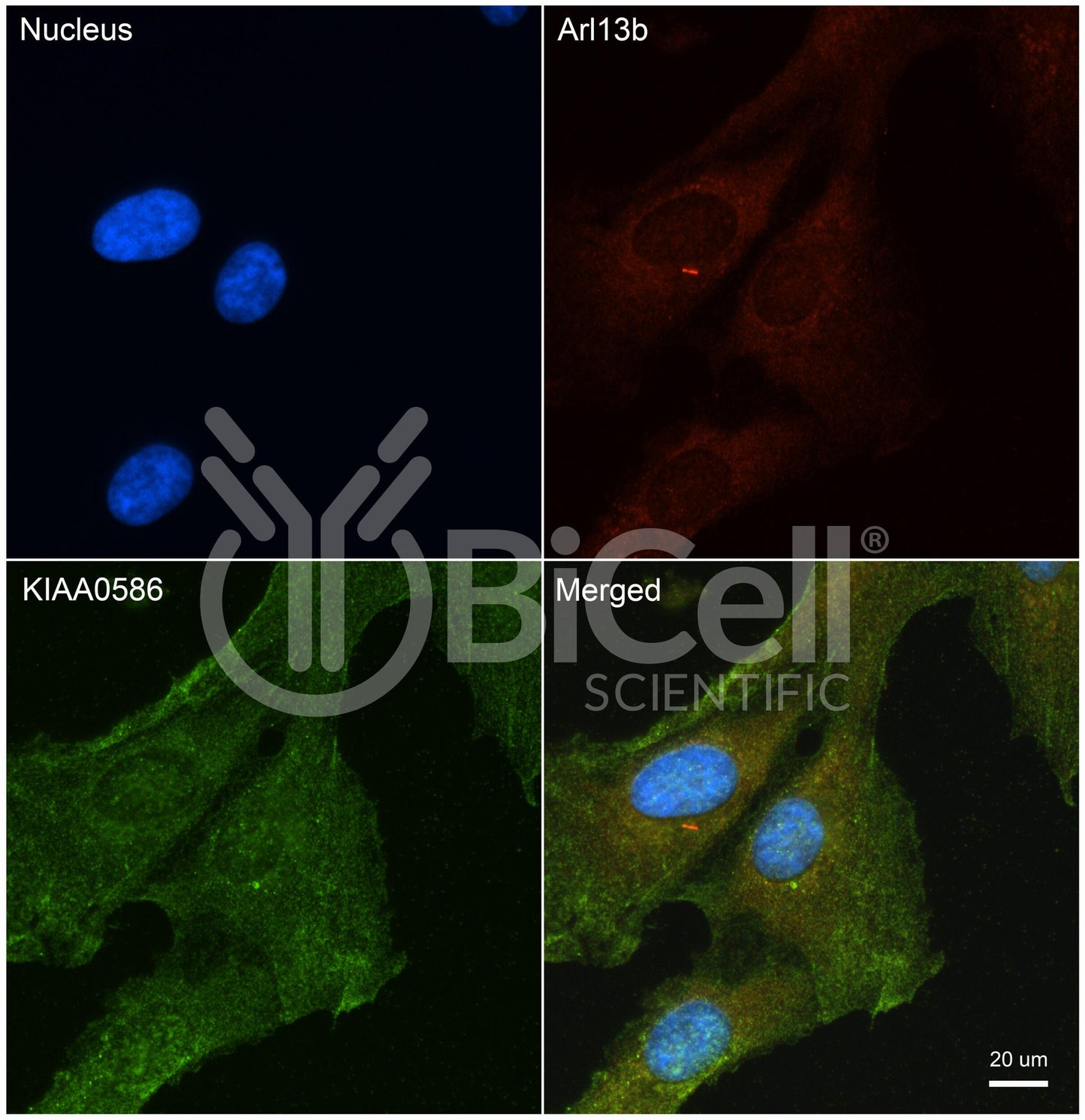 KIAA0586 (TALPID3) Antibody - Western Blot Validated