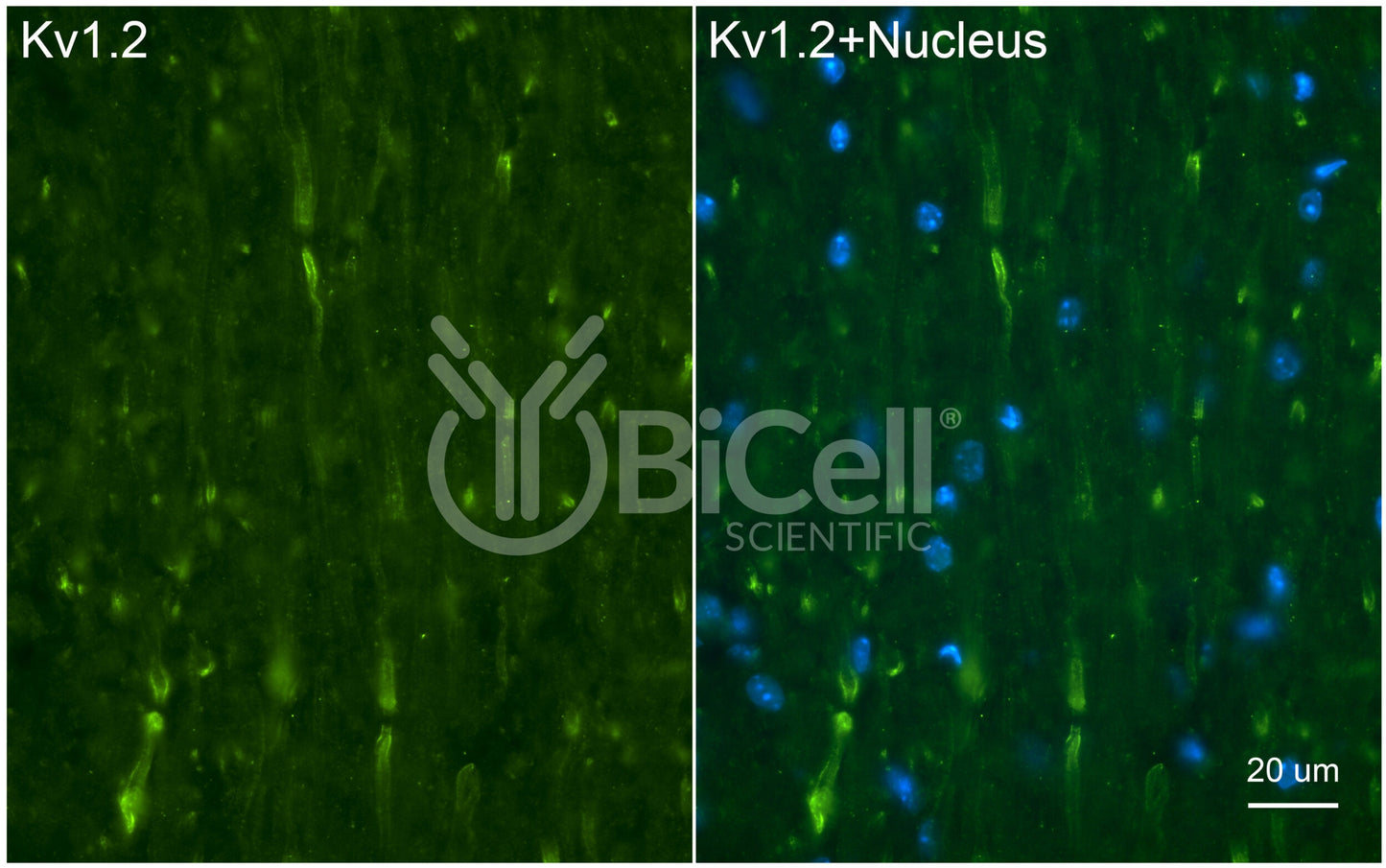 KCNA2 (Kv1.2) Antibody - FFPE Validated