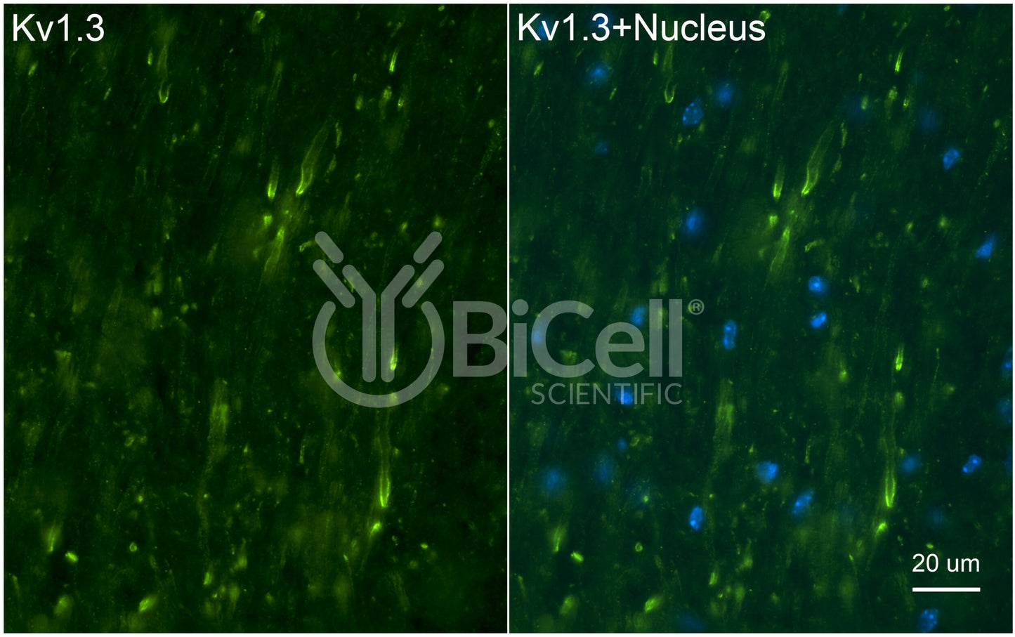 KCNA3 (Kv1.3) Antibody - Western Blot Validated