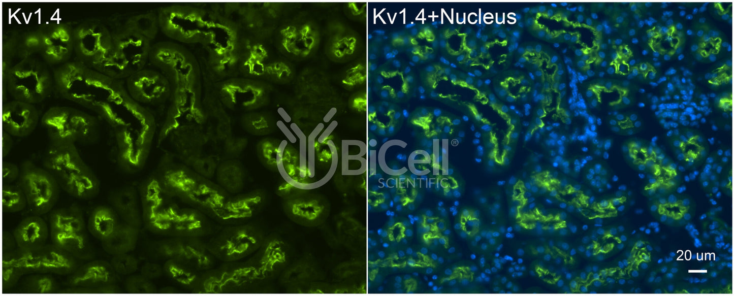 KCNA4 (Kv1.4) Antibody - FFPE Validated